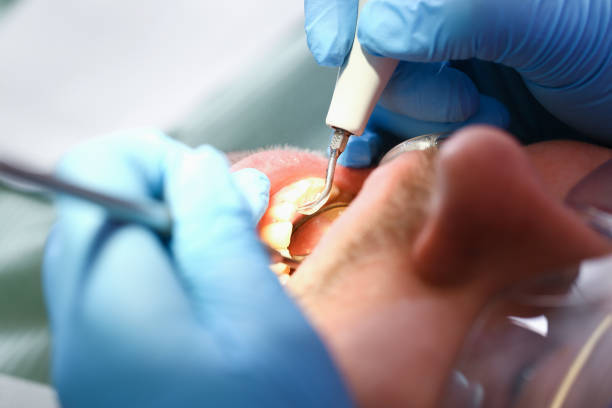 Best Tooth Infection Emergency Dentist  in Weyers Cave, VA